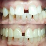 Union Dental Centre (Fairview) - Photo 4