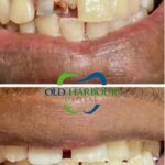 Old Harbour Dental - Photo 6