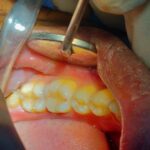 Royale Dental Care - Photo 4