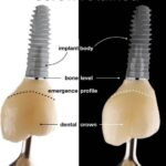 Dr. Omid Termechi - Photo 4