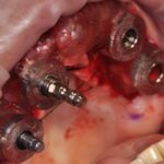 Dr. Omid Termechi - Photo 5