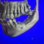 Dr. Omid Termechi - Photo 6