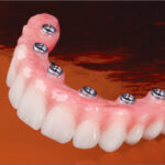 Indrajeet Singh,DDS - Photo 1