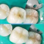 Restorative Dental - Photo 7