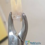 York Family Dental Ja - Photo 7