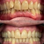 Apex Family Dental PC - Photo 2