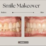 Tribeca Dentist - Empower Your Smile - Photo 5