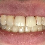 The Tribeca Dentist: Dr. Paolo Saggese - Photo 4