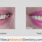 Tribeca Advanced Dentistry by Dr. Olga Malkin - Photo 4