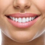 Chelsea Dental Aesthetics: David Blaustein, DDS - Photo 4