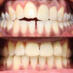 All Smiles on 12th St. - Photo 3