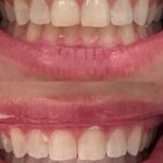 Tend Dental East Village - Photo 4