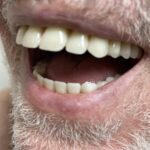 212 Smiling Cosmetic Dentistry - Photo 5