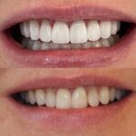 Cosmetic Dentistry Center NYC - Dr. Pia Lieb - Photo 2