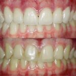 Cosmetic Dentistry Center NYC - Dr. Pia Lieb - Photo 4