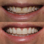 Lux Smiles NYC - Photo 6