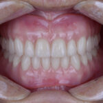 Blue Dental - Photo 3