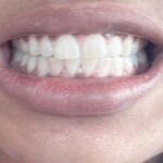 National Dental Upper East Side - Photo 4