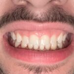 National Dental Upper East Side - Photo 6