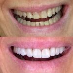 Dentistry on Park - Dr Daniil Payziyev - Photo 4