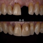 Fort Washington Dental Associates - Photo 2