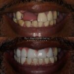 Fort Washington Dental Associates - Photo 3