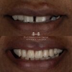 Fort Washington Dental Associates - Photo 6