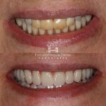 Fort Washington Dental Associates - Photo 7