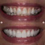 The Smile Code - Photo 1