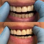 A&E Dental - Dentist in Floral Park - Photo 5