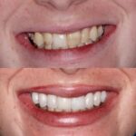 Scott H. Froum, DDS - Periodontist in Manhattan, NYC - Photo 2