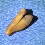 Emergency Dentist NYC - Photo 6