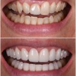 Dr. Alex Rubinov - NYC Cosmetic Dentist - Photo 2