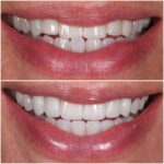 Dr. Alex Rubinov - NYC Cosmetic Dentist - Photo 3