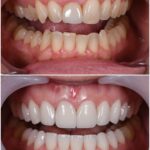 Dr. Alex Rubinov - NYC Cosmetic Dentist - Photo 5