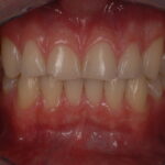 DENISE CRAIG Dental Hygienist - Photo 2