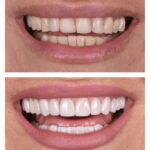 No Limits Dental Midtown Manhattan - Photo 2