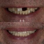 Fort Washington Dental Associates - Photo 5