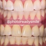 Photo Ready Smile - Photo 2