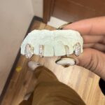 Photo Ready Smile - Photo 3