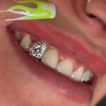 Photo Ready Smile - Photo 6