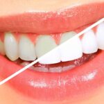 HQteethwhitening - Photo 2