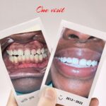 HQteethwhitening - Photo 4
