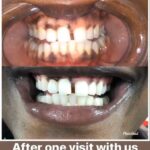 HQteethwhitening - Photo 5