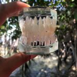 Pure Dental Care - Photo 5