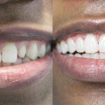 Upper West Side Dental - Photo 7