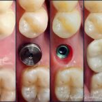 Dr. Mustapha Rammal DDS FICOI - Photo 3