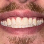 Core Smiles - Photo 5