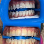 Whitening Bar NYC - Photo 1