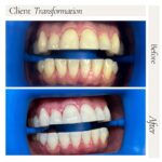 Whitening Bar NYC - Photo 2